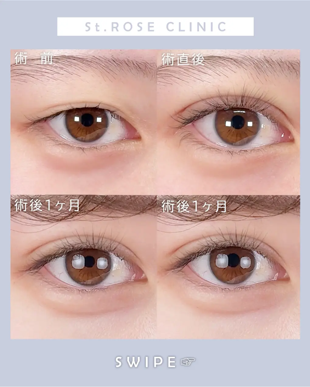 症例画像