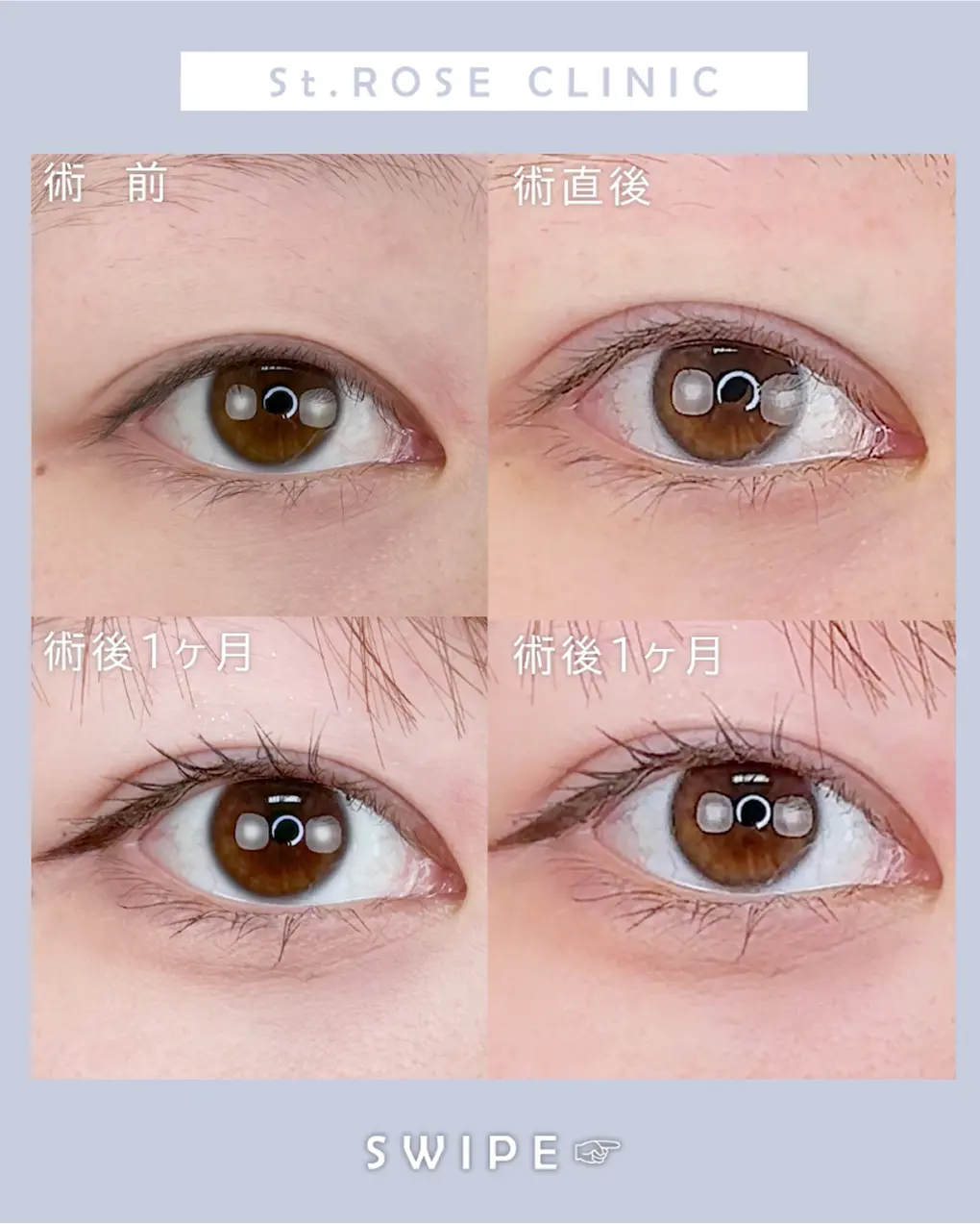 症例画像