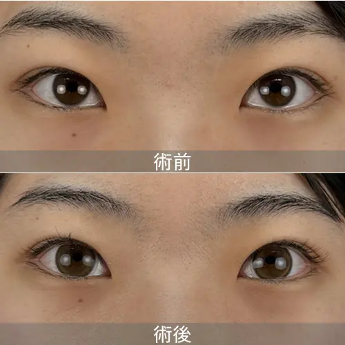 症例画像
