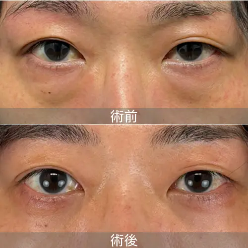 症例画像