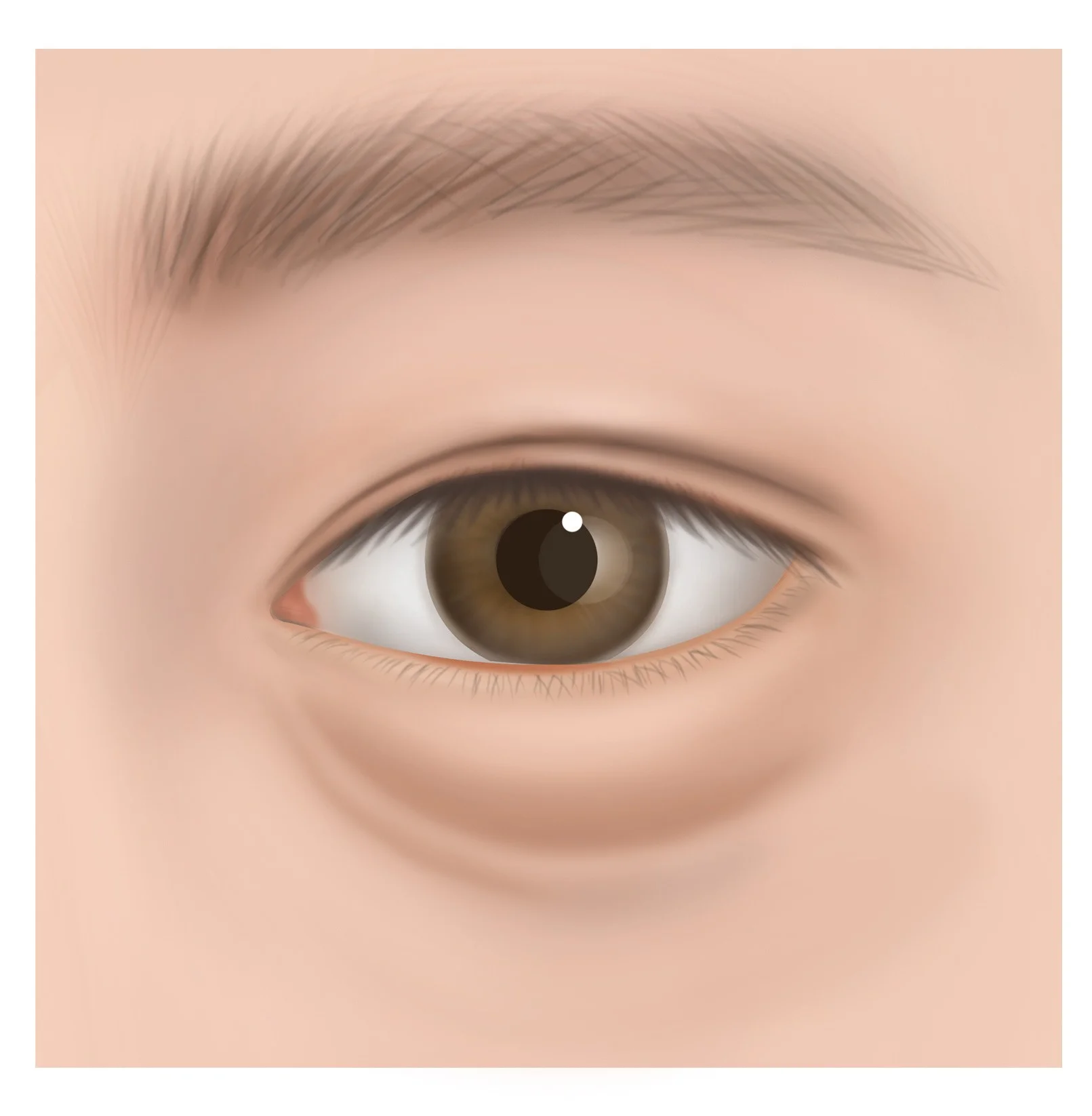 STEP 1