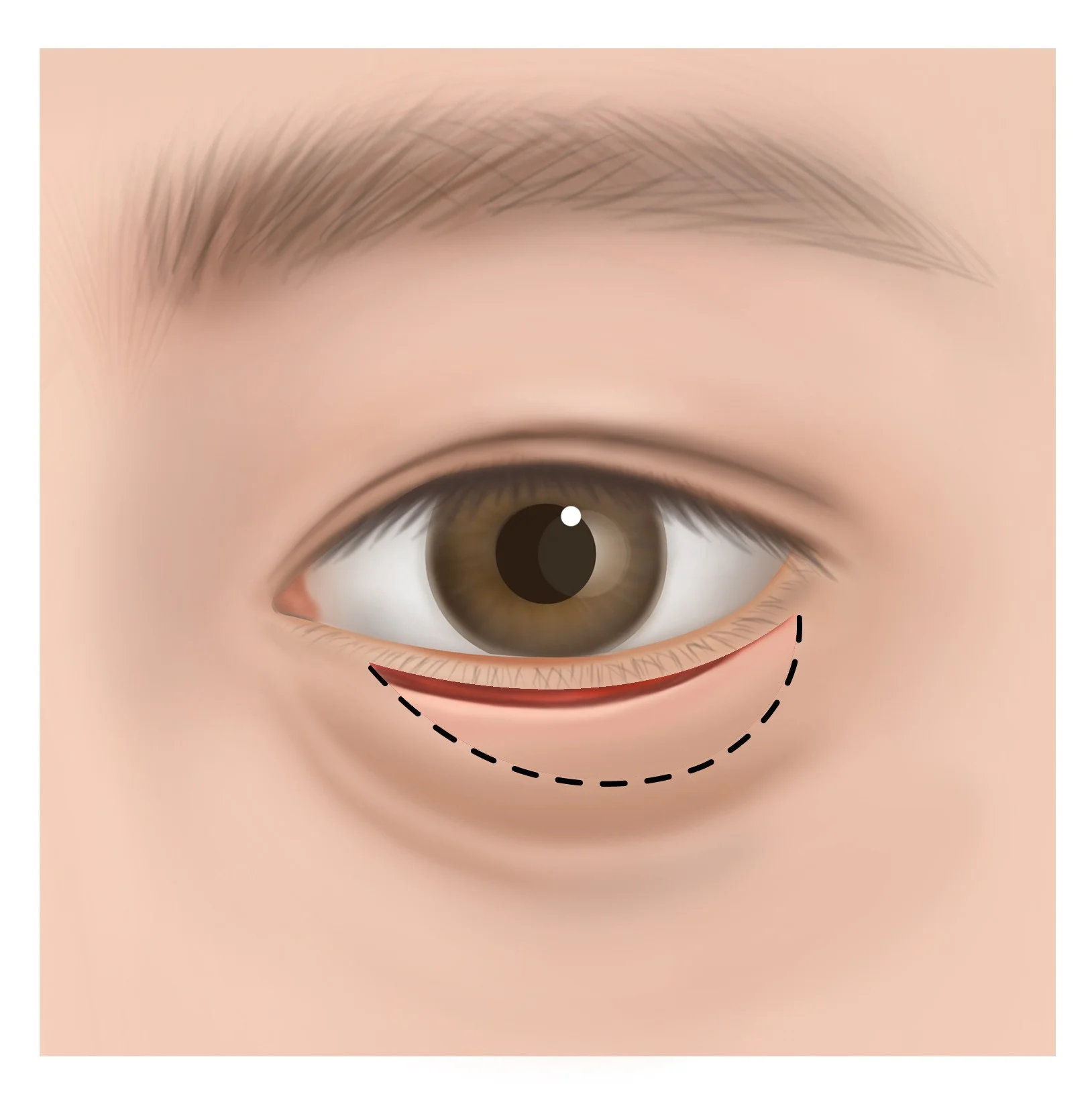 STEP 2