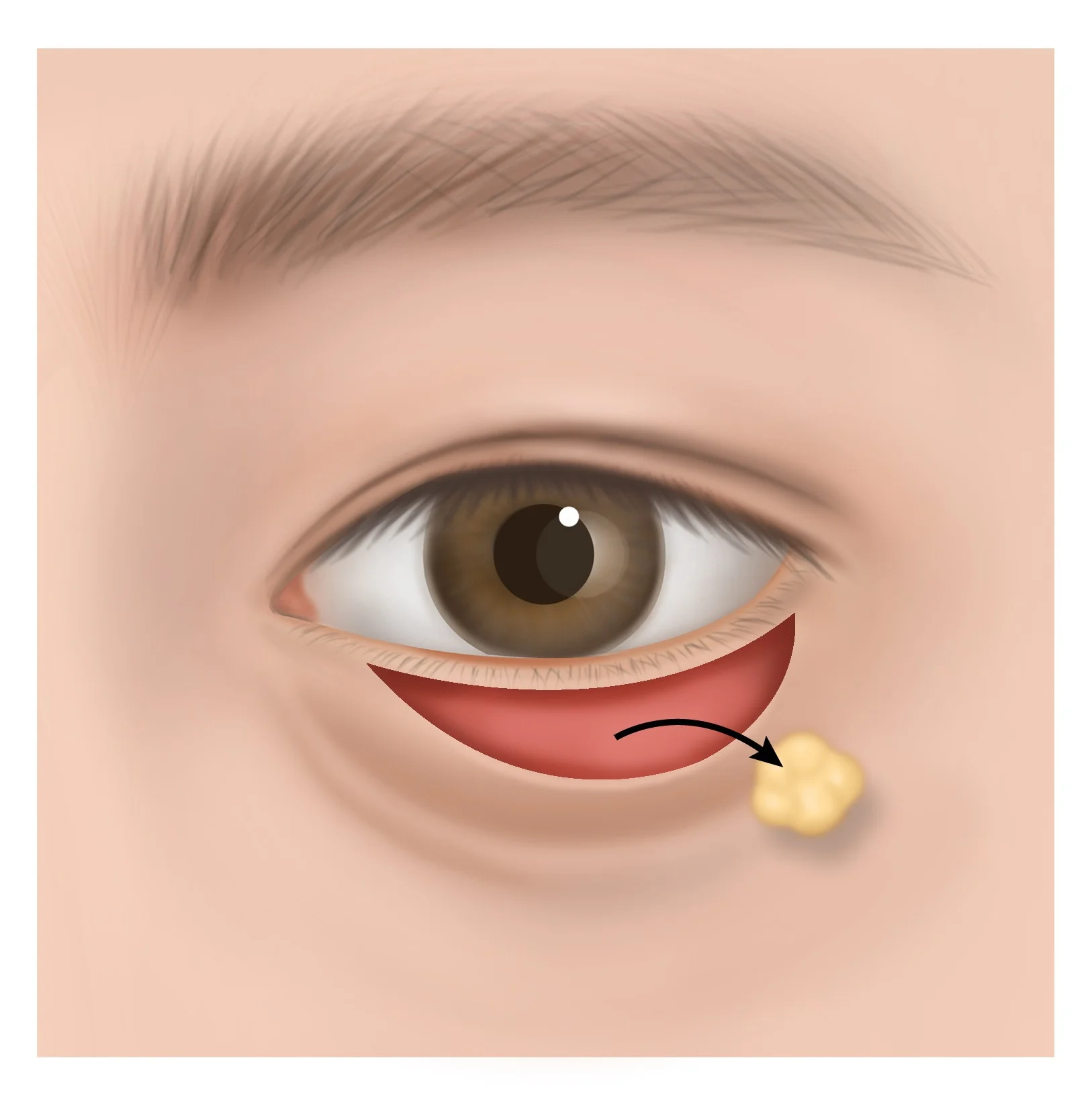 STEP 3