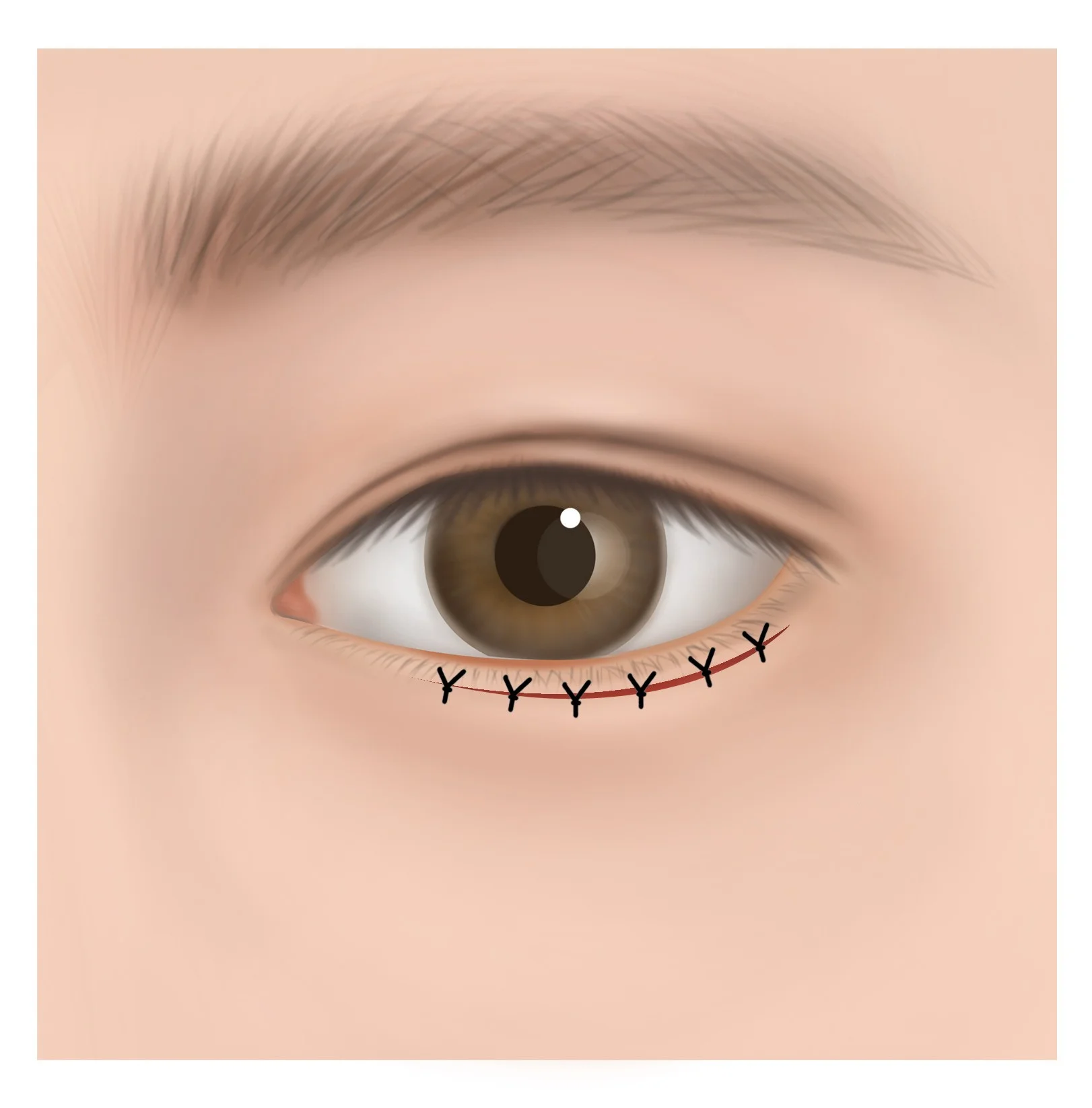 STEP 4