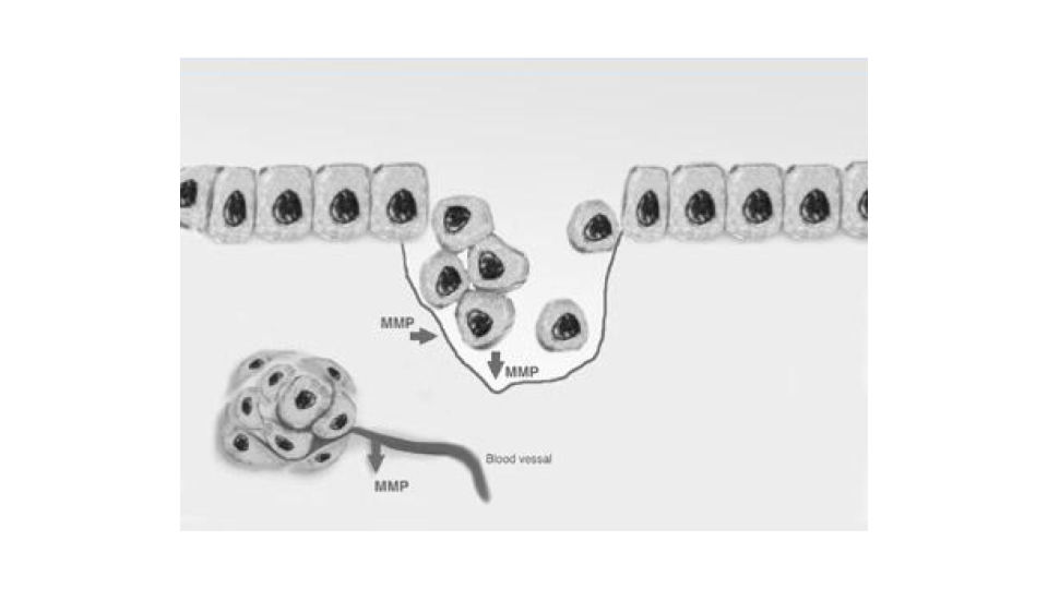 1．MMPs（Matrix Metalloproteinases）の抑制