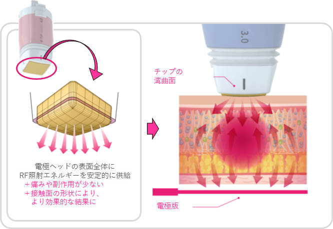 1．痛みのコントロール