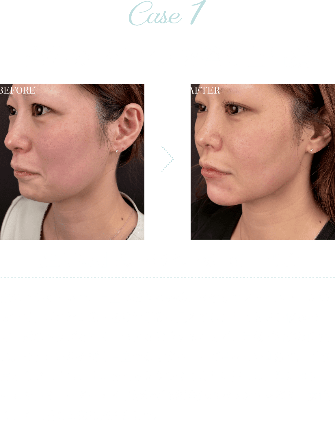 Case1
