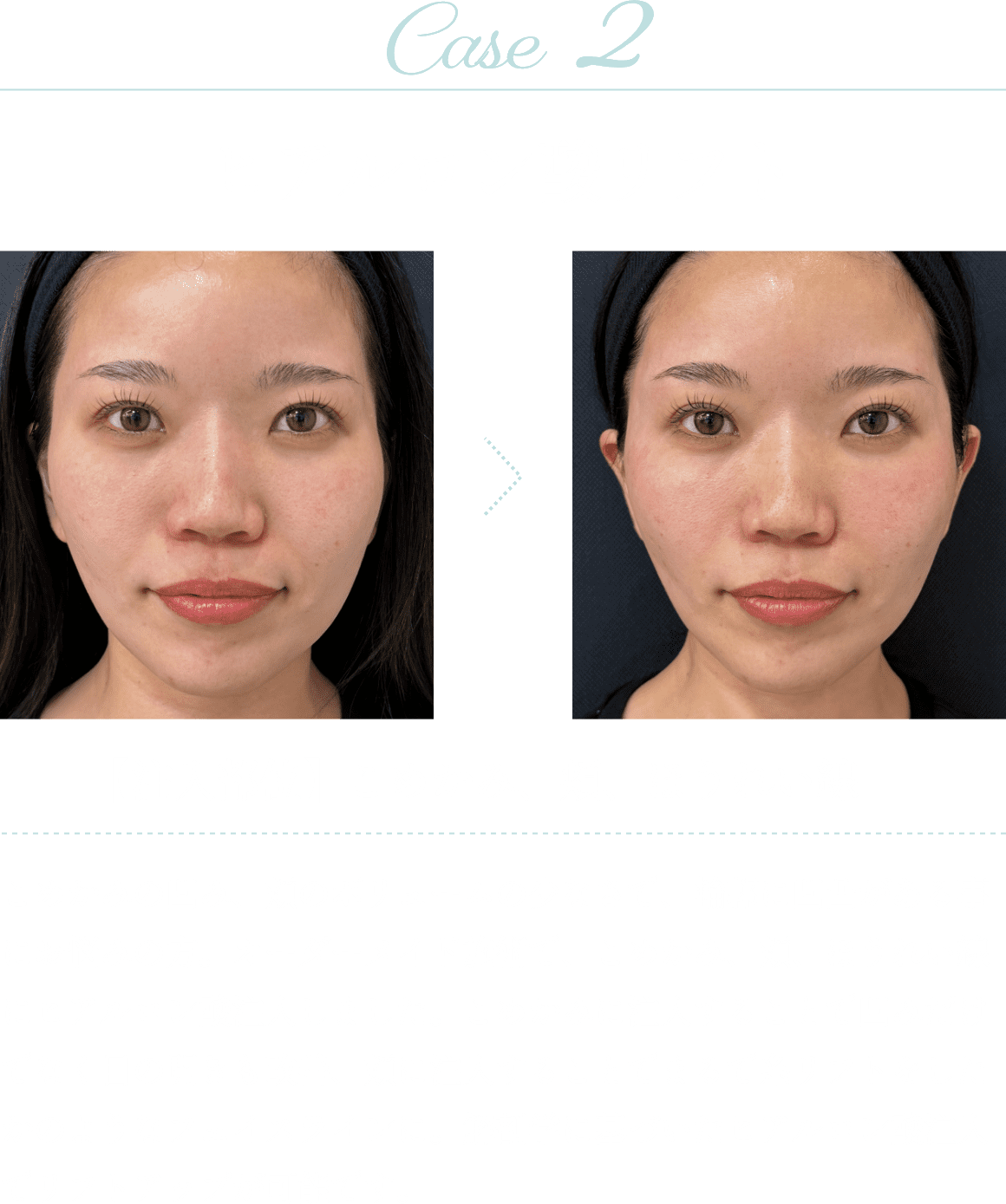 Case2