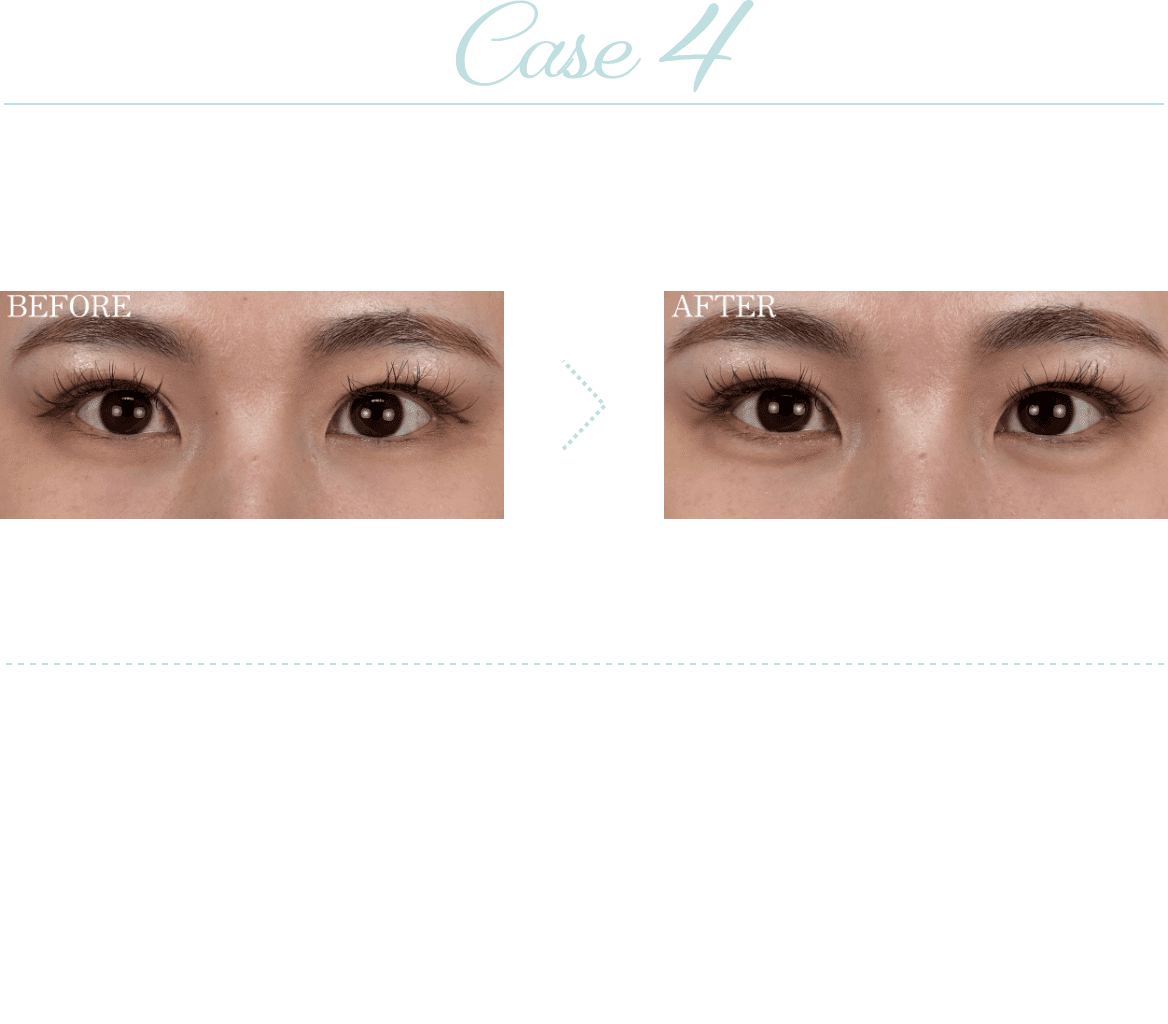 Case4