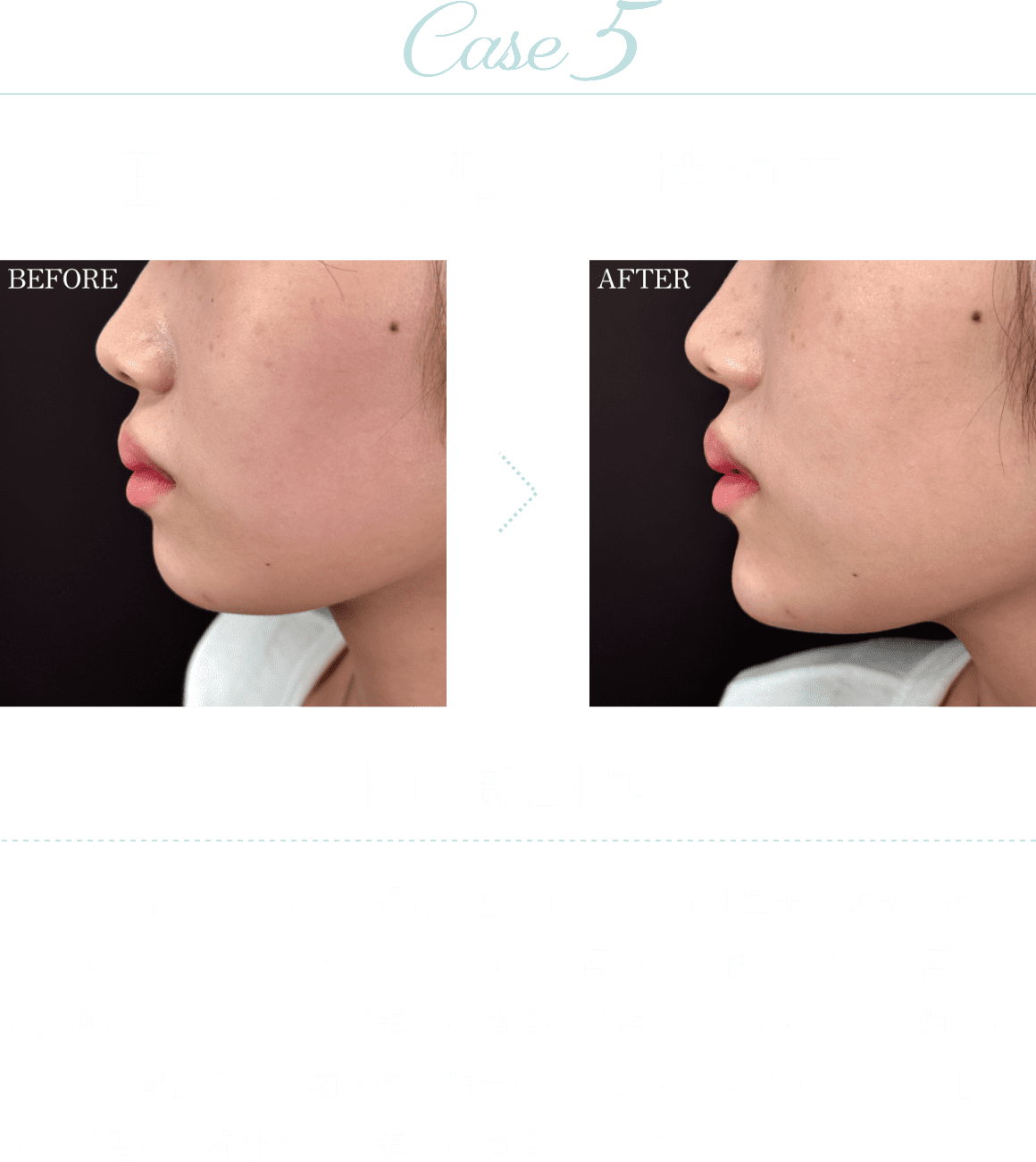 Case5