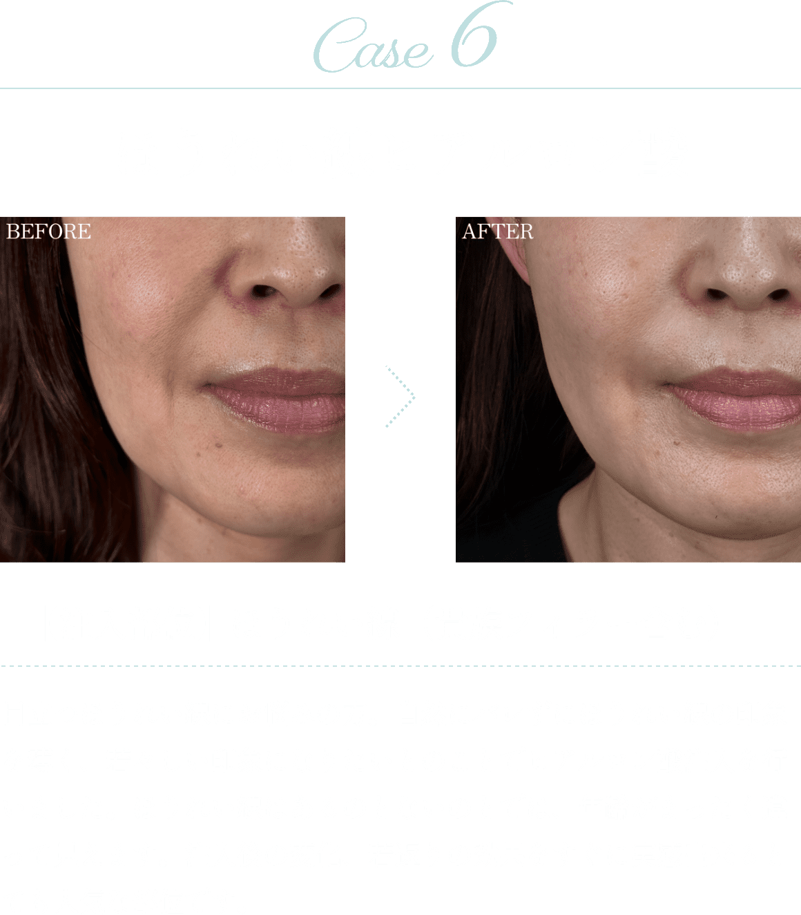 Case6