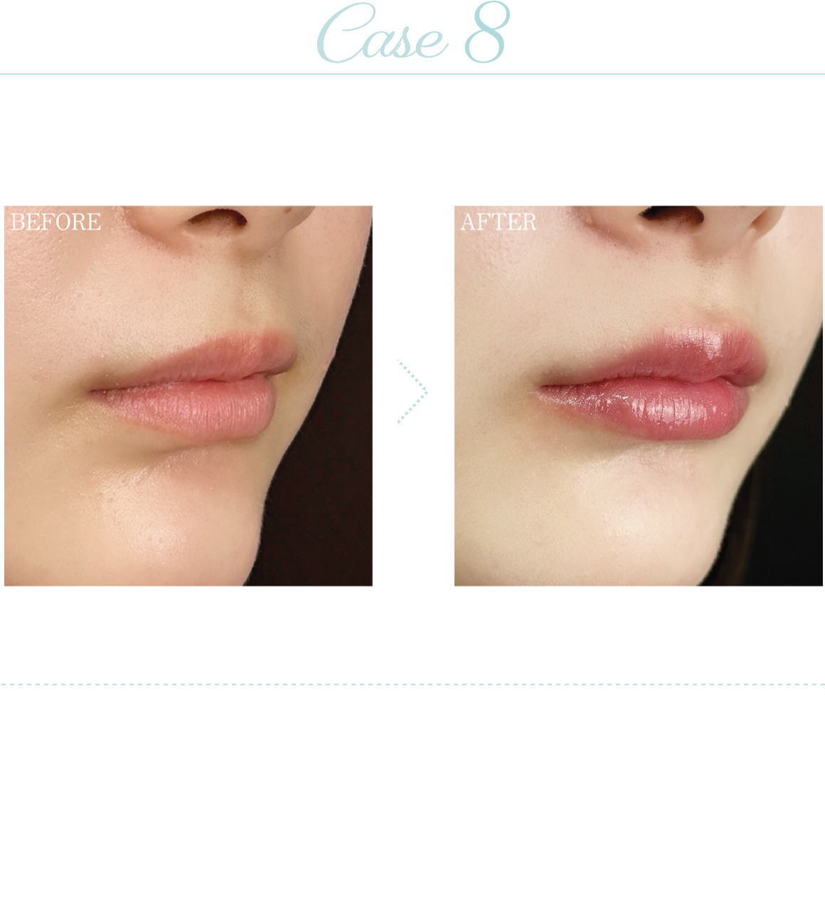 Case6