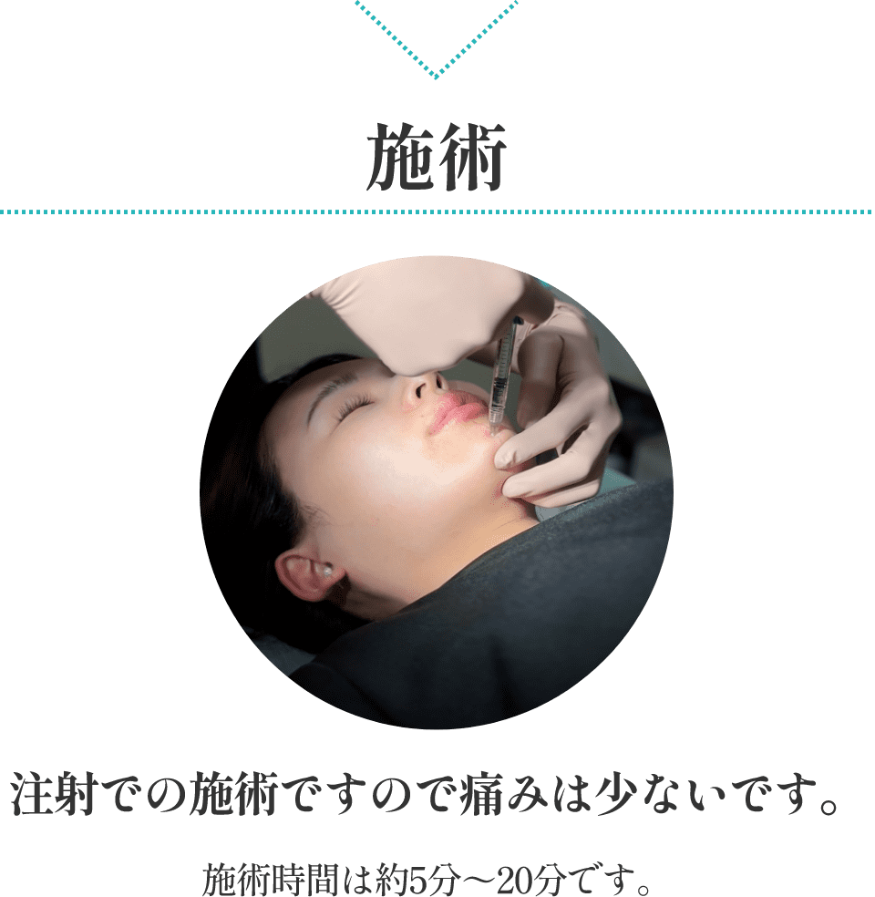 施術