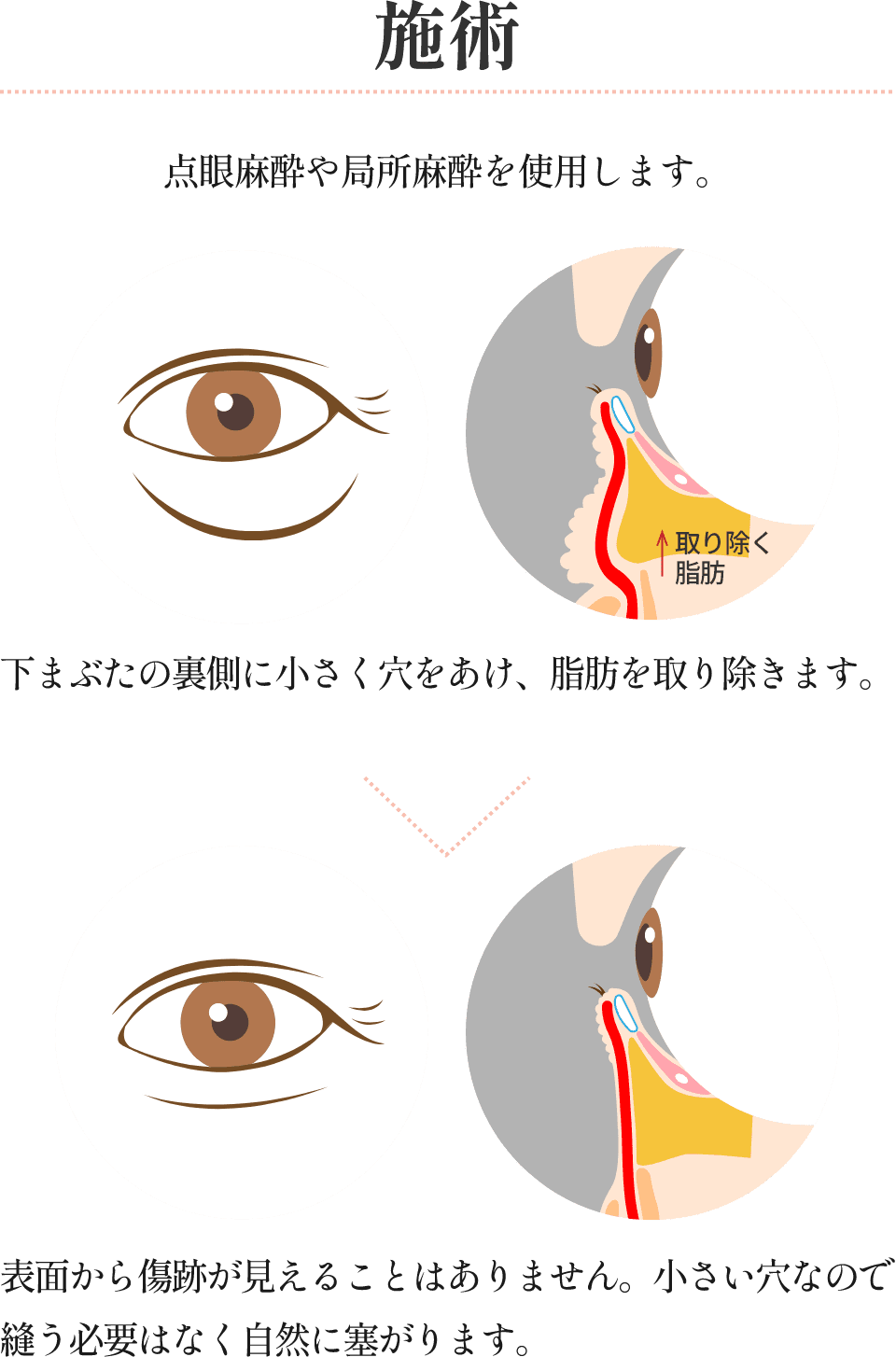 施術